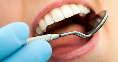 Stire din Sănătate : Ce alegem: implant sau punte dentară?