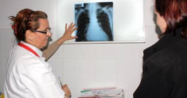 Stire din Sănătate : Ce boală pulmonară poate provoca decesul pacienților
