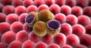 Celulele cancerului mamar au fost transformate, cu succes, în grăsime. Procesul oprește apariția metastazelor