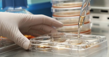 Stire din Sănătate : Existența celulelor stem canceroase, confirmată