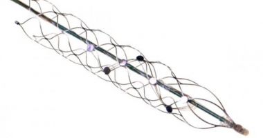 Stire din Actualitate : Un neurocip a fost implantat în creierul uman pentru prima dată
