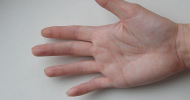 Stire din Sănătate : „Citiţi” bolile din palmă!