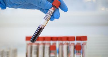 Stire din Actualitate : Un caz suspect de ciumă bubonică, raportat de autorităţi