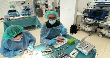 Implantul subperiostal poate fi efectuat la Clinica M&M Dental Team Constanța - 4