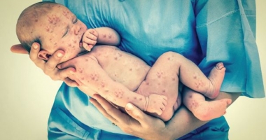 Stire din Sănătate : SITUAȚIE ALARMANTĂ ÎN ROMÂNIA! Mulți părinți refuză "mascat" vaccinarea copiilor