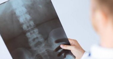 Stire din Sănătate : DESCOPERIRE IMPORTANTĂ! Coloana vertebrală este mai ''inteligentă'' decât se credea anterior