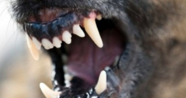 Stire din Eveniment : Constănțeancă mușcată  de un câine agresiv