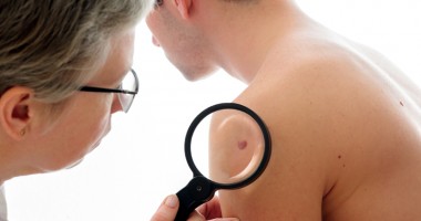 Stire din Sănătate : Constănțenii pot benefica de testări gratuite pentru cancerul de piele