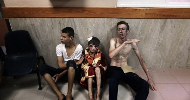 IMAGINI ȘOCANTE! Copii din Fășia Gaza, spulberați de bombe - 5