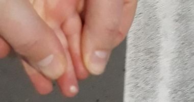 Un copil a ajuns la spital, după ce s-a electrocutat la un bancomat - 2