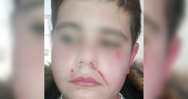 Anchetă a Poliției în cazul elevului bătut la școala "Dan Barbilian" din Constanța
