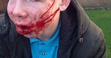 IMAGINI ȘOCANTE. Un băiat de 15 ani a fost bătut crunt pe drumul de la școală spre casă - 2