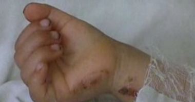 Stire din Actualitate : Doi frați de 3 ani și 5 ani, opăriți cu apă clocotită când părinții erau la cumpărături