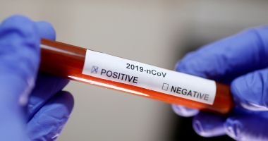Coronavirus: Niciun județ fără cazuri noi. Unde au fost raportate cele mai multe infectări în 24 de ore