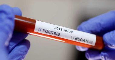 Angajată a ministerului Sănătății, infectată cu coronavirus. 12 persoane au fost izolate la domiciliu