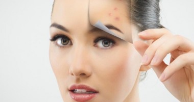 Stire din Diverse : Ce probleme indică apariția coșurilor