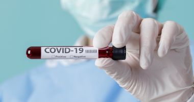 Stire din Social : COVID-19. Creștere alarmantă a cazurilor de îmbolnăvire, în țară