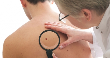 Stire din Sănătate : Metoda folosită  cu succes în tratarea afecțiunilor dermatologice  ale copiilor