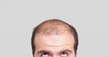 Stire din Actualitate : Adio, chelie! A fost aprobat primul medicament împotriva alopeciei