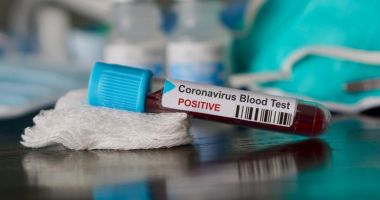 Stire din Eveniment : COVID-19 / Bilanțul deceselor a ajuns la 184