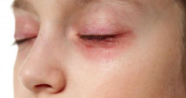 Stire din Eveniment : Au ajuns la spital cu arsuri la ochi! Cauza a fost una neașteptată…