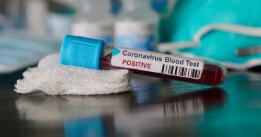 Stire din Eveniment : UN NOU CAZ DE CORONAVIRUS confirmat în România! Nu prezintă simptome