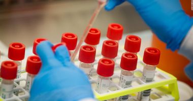 Stire din Actualitate : Test de coronavirus, autorizat de urgență în SUA