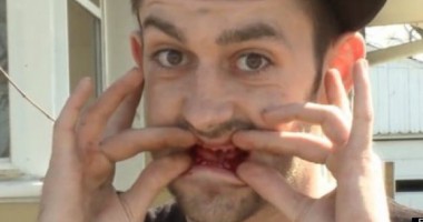 Stire din Actualitate : S-a trezit cu toți dinții scoși după ce a mers la dentist