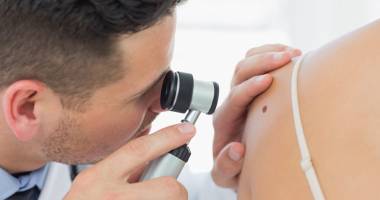 Stire din Sănătate : Depistați din timp afecțiunile dermatologice!