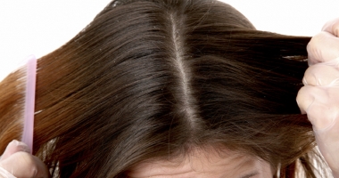 Stire din Sănătate : Cum puteți scăpa ușor de dermatita seboreică