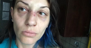 IMAGINI ȘOCANTE. SOLISTA UNEI FORMAȚII ROMÂNEȘTI, SNOPITĂ ÎN BĂTAIE, ÎN PARC: "NEAVÂND CE SĂ-MI FURE, M-AU BĂTUT" - 2