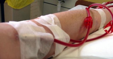 Stire din Sănătate : Pacienții care necesită dializă  au fost aduși la spital