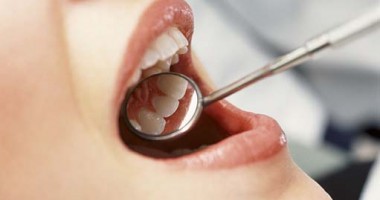 Stire din Sănătate : De ce trebuie să mergem de două ori pe an la dentist