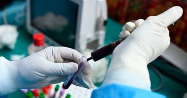 Stire din Sănătate : Pacienții care s-au vindecat de COVID-19 pot ajuta la salvarea de vieți