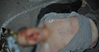 IMAGINI ȘOCANTE / Accident rutier GRAV la ieșire din Mamaia. Un motociclist a lovit un pieton. Ambii au MURIT - 6