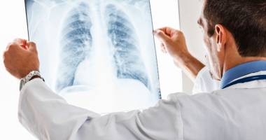 Stire din Sănătate : Durerea toracică  poate fi semn  al cancerului de plămâni