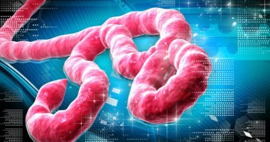 Stire din Actualitate : Epidemie Ebola / "Structurile sanitare să fie pregătite pentru o nouă deteriorare a situației"