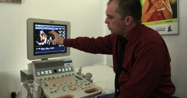 Stire din Sănătate : Cum poate fi depistat precoce cancerul colorectal