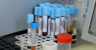 Stire din Sănătate : Campanie de luptă împotriva hepatitei