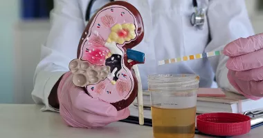 Stire din Sănătate : Examenul de urină. Când este recomandat și ce informații oferă