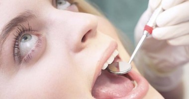Stire din Sănătate : Ce trebuie să știți despre fațetele dentare