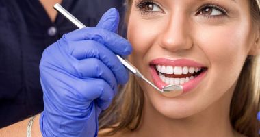 Vreți dinți mai albi? Aveți nevoie de fațete dentare