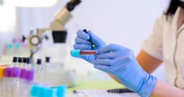 Stire din Actualitate : Reuniune de urgenţă a OMS privind epidemia de febră hemoragică