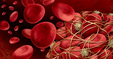 Stire din Sănătate : Fibrinogenul, indicatorul care vă arată dacă sângele se coagulează corect