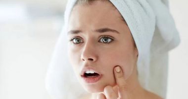 Stire din Sănătate : Cele mai eficiente metode de eliminare a cicatricilor post-acnee