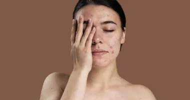 Stire din Sănătate : Cicatricile pielii. Ce le influențează și cum se estompează în timp