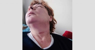 Dragoste cu maxilare rupte în Valu lui Traian. "El crede că mama este o piedică în viaţa lui" - 3