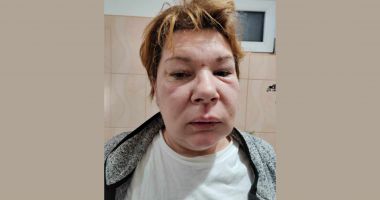 Dragoste cu maxilare rupte în Valu lui Traian. "El crede că mama este o piedică în viaţa lui" - 5