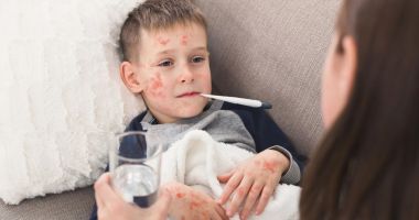 Stire din Sănătate : Simptomele rujeolei apar la aproximativ două săptămâni de la infectare