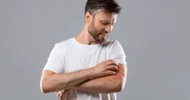 Stire din Sănătate : Alimente care ameliorează urticaria. Ce să eviți și ce să adaugi în farfurie